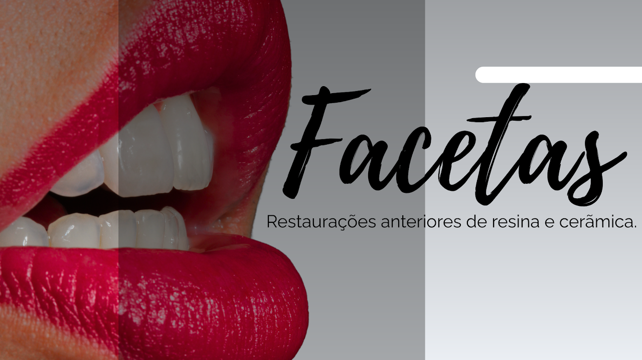 Curso de Facetas